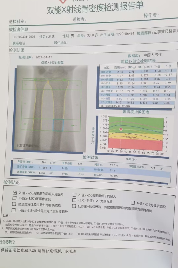 雙能X射線骨密度儀：準(zhǔn)確測(cè)量骨密度，助力骨質(zhì)疏松防治，守護(hù)骨骼健康